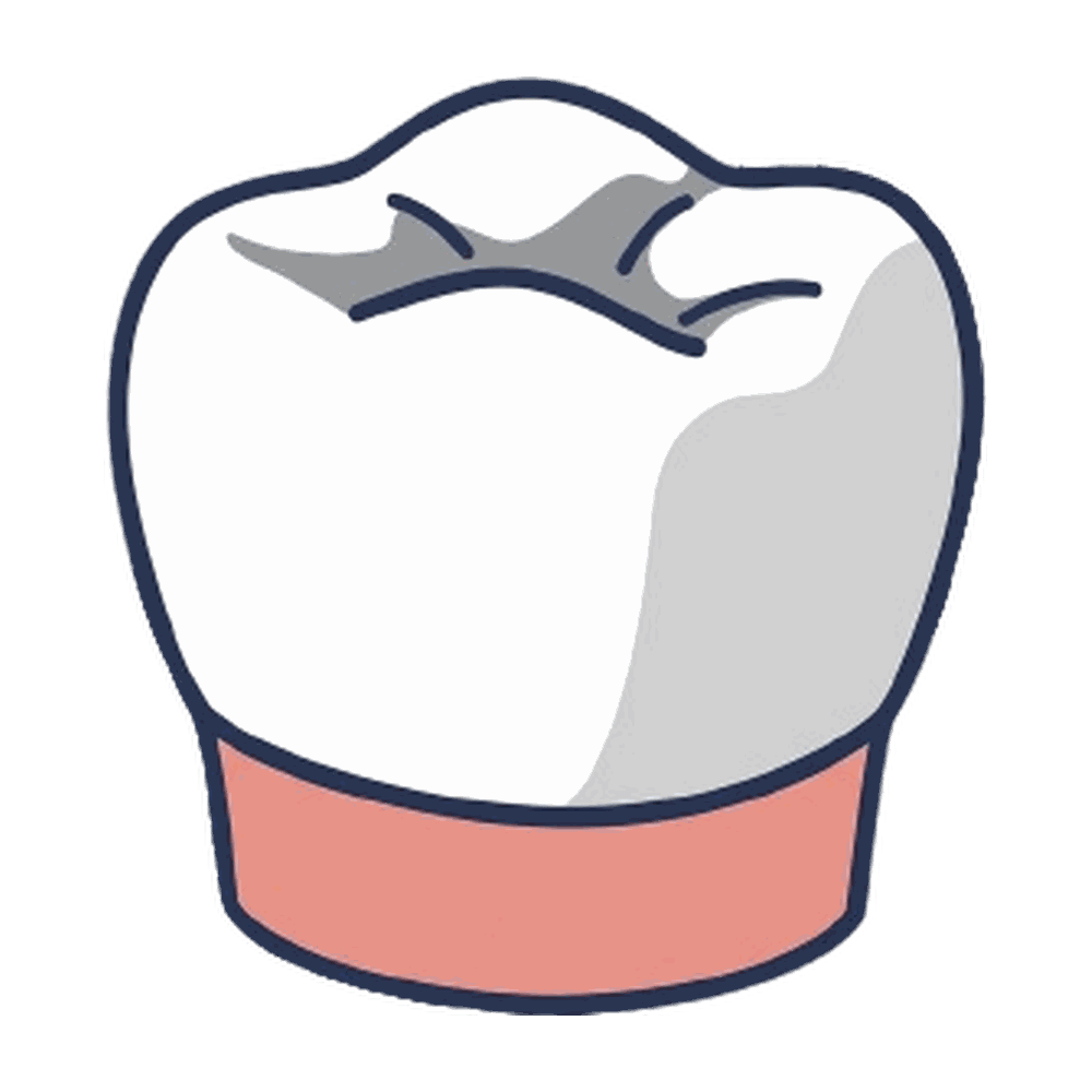 詰め物・被せ物のイラスト素材