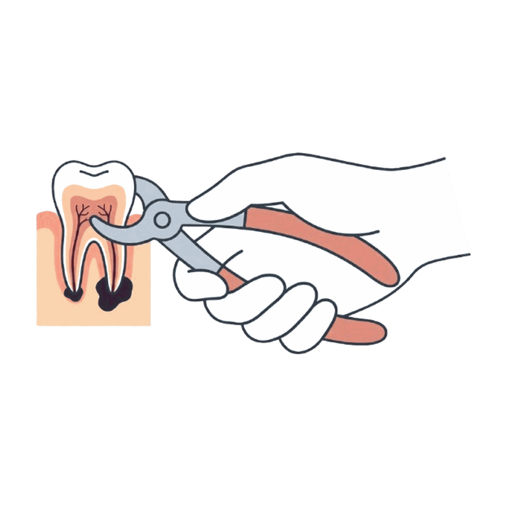 抜歯のイラスト素材
