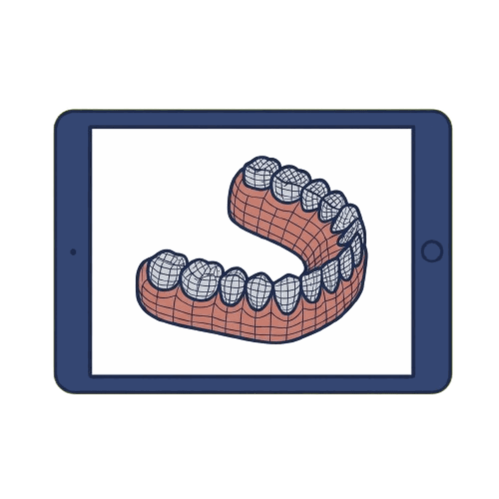 マウスピース矯正（タブレット）のイラスト素材