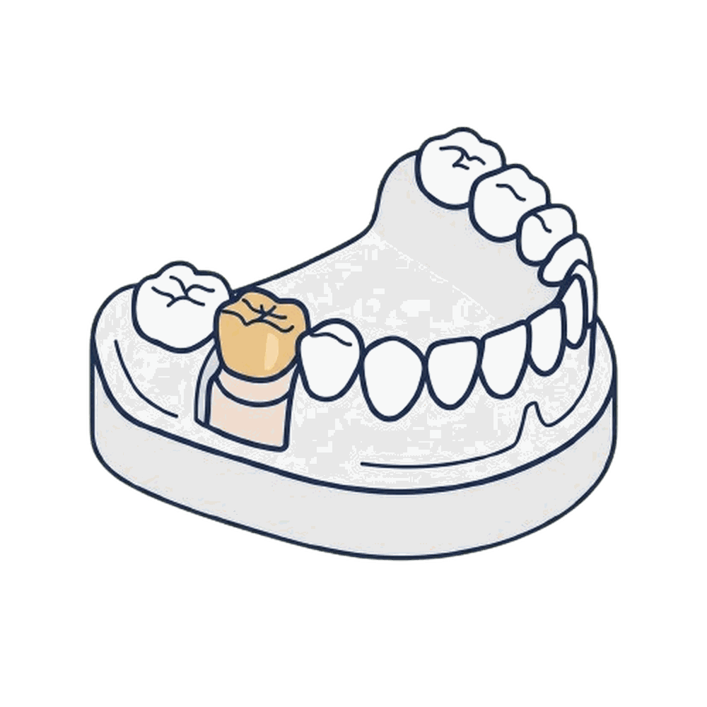 総入れ歯（上顎）のイラスト素材