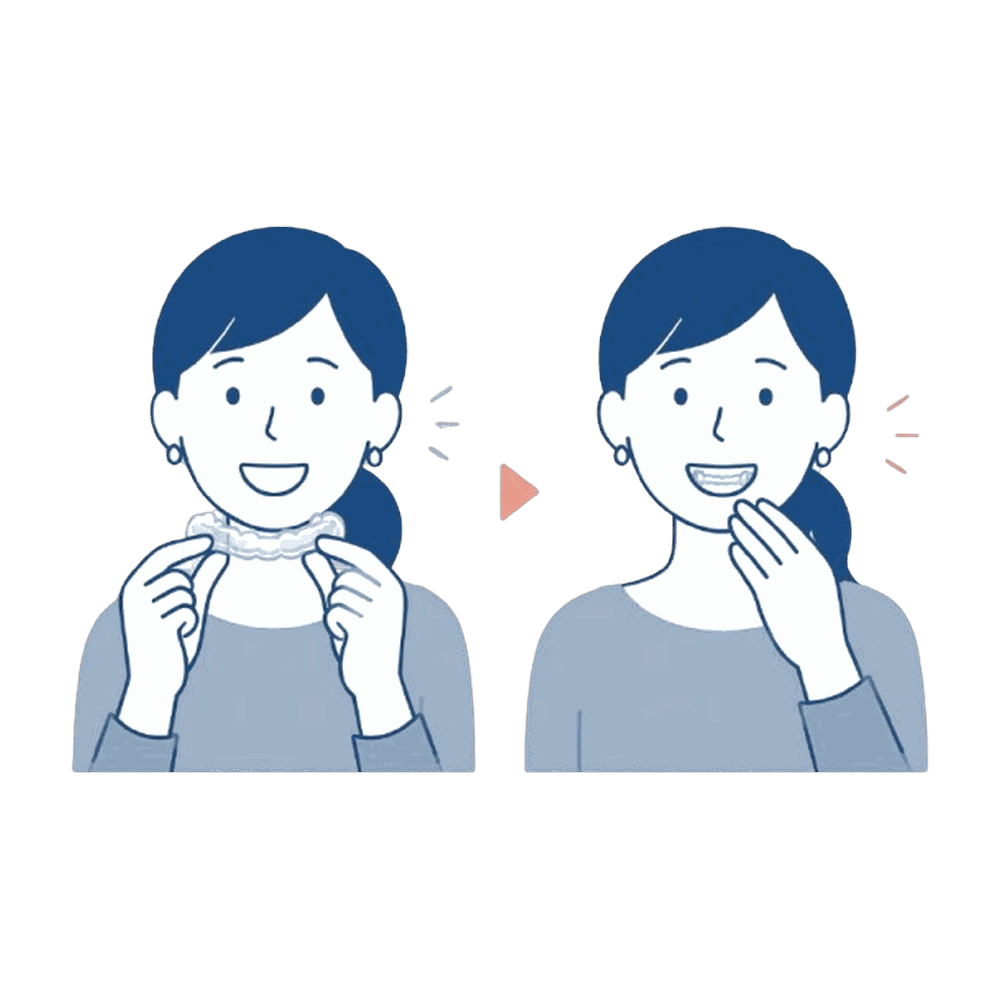 マウスピースを装着する女性（リテーナー）のイラスト素材