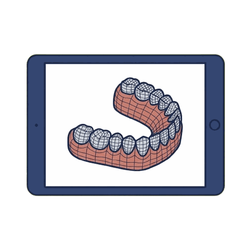 マウスピース矯正（タブレット）のイラスト素材