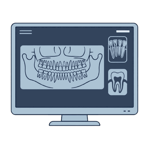 モニターに表示したパノラマX線のイラスト素材