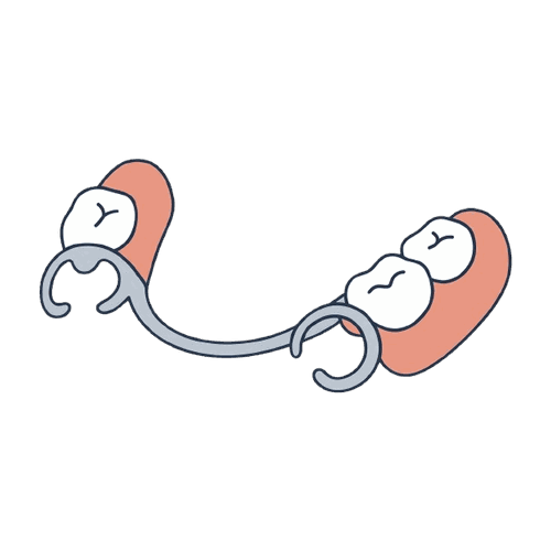 部分入れ歯（クラスプ義歯）のイラスト素材