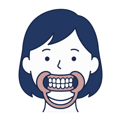 開口器をつけた女性（口腔内カメラ）のイラスト素材